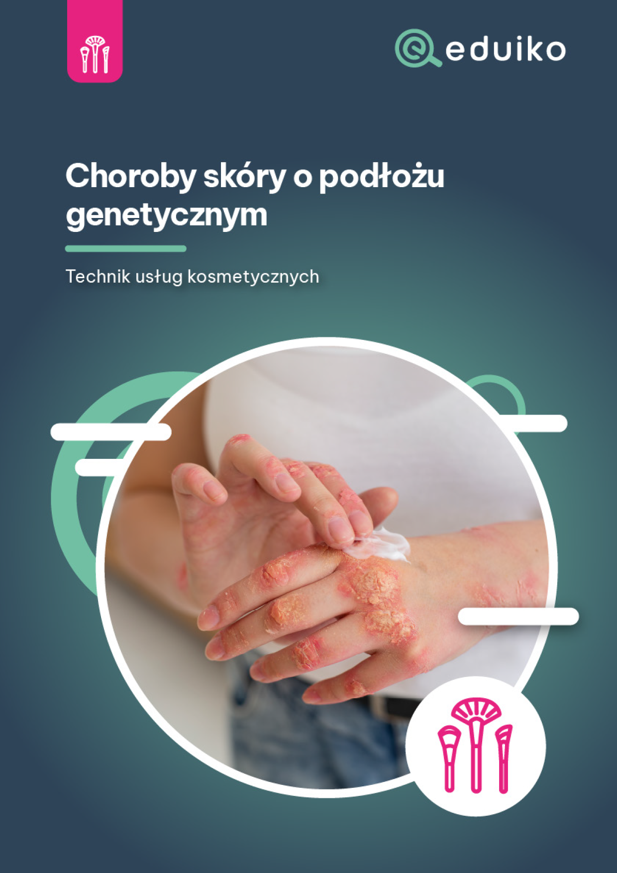 Z.TUK-Choroby skóry o podłożu genetycznym